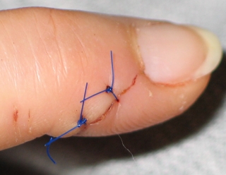 finger 6